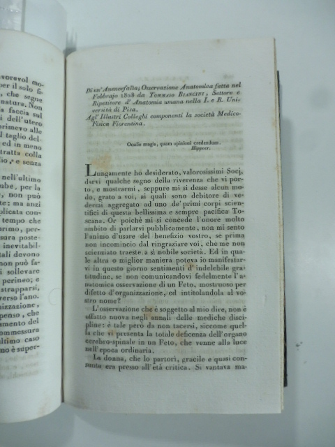 Di un anencefalia osservazione anatomica fatta nel febbrajo 1828 da T. Biancini...(Stralcio da: Nuovo giornale de' letterati. N. 44. 1829)